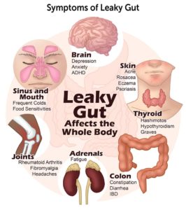 A Deeper Dive In Understanding Intestinal Permeability (or Leaky Gut